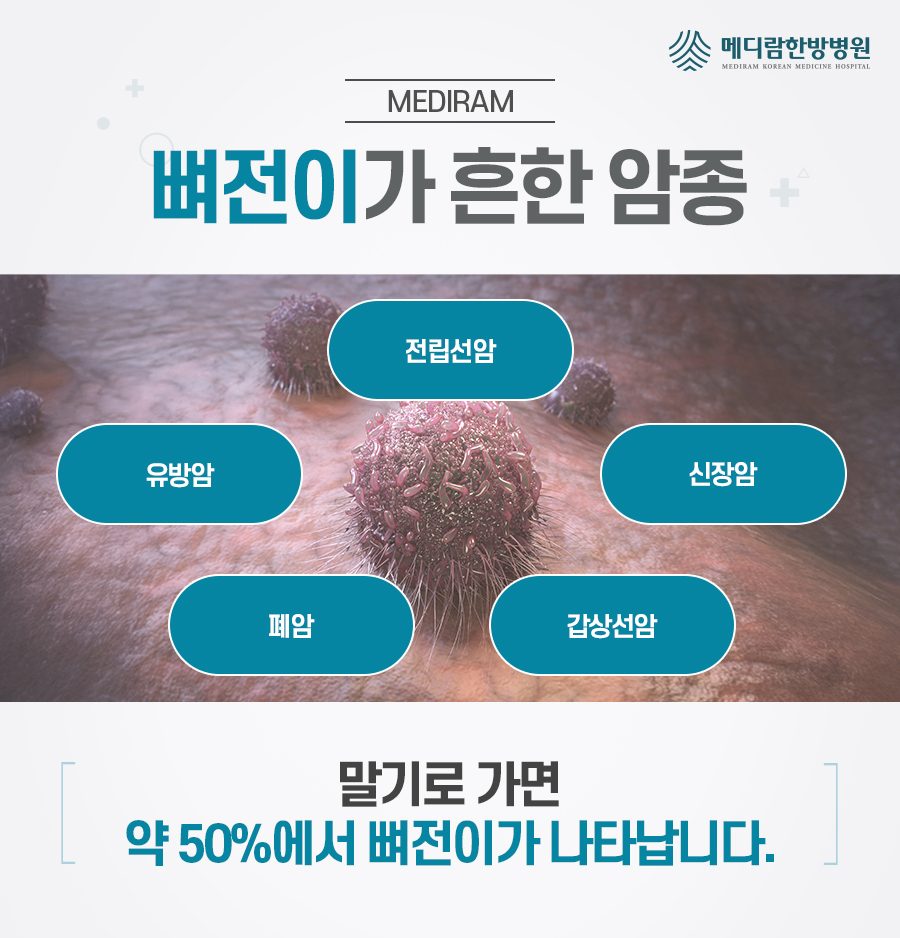 뼈전이가 흔한 암종을 정리한 자료