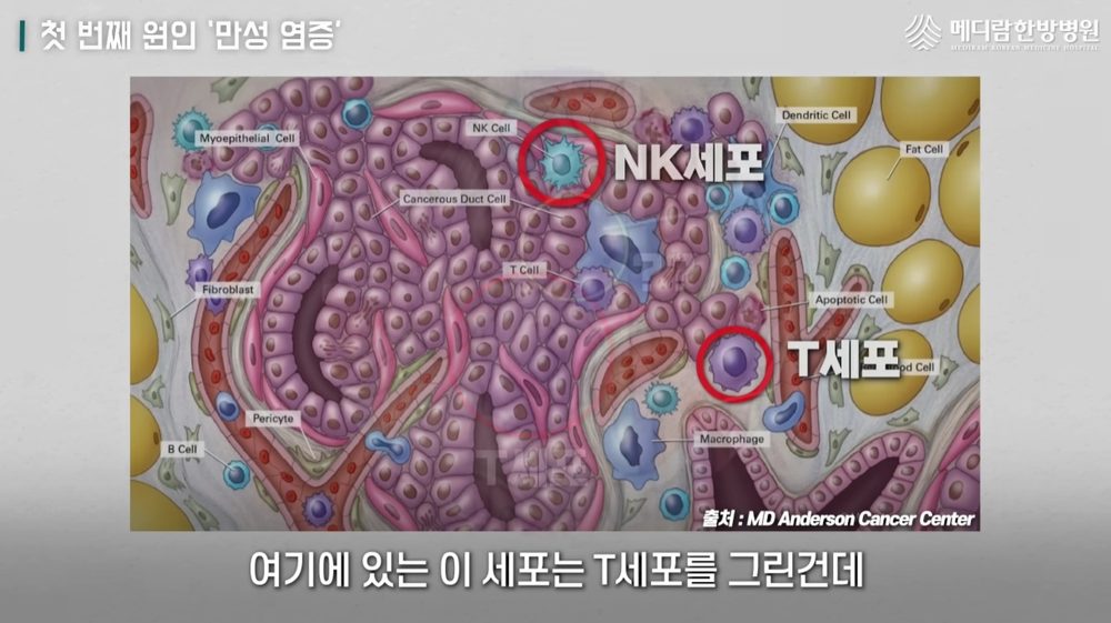 암 전이와 면역세포의 관계를 설명하는 자료 화면