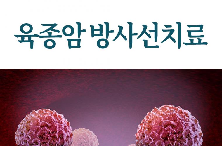 육종암 방사선치료