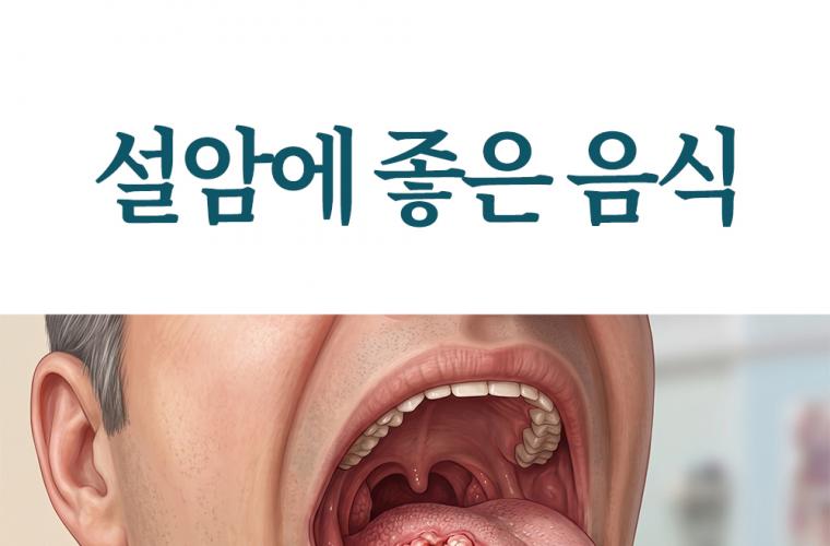 설암에 좋은 음식 수술 전후 식단 가이드 썸네일 이미지