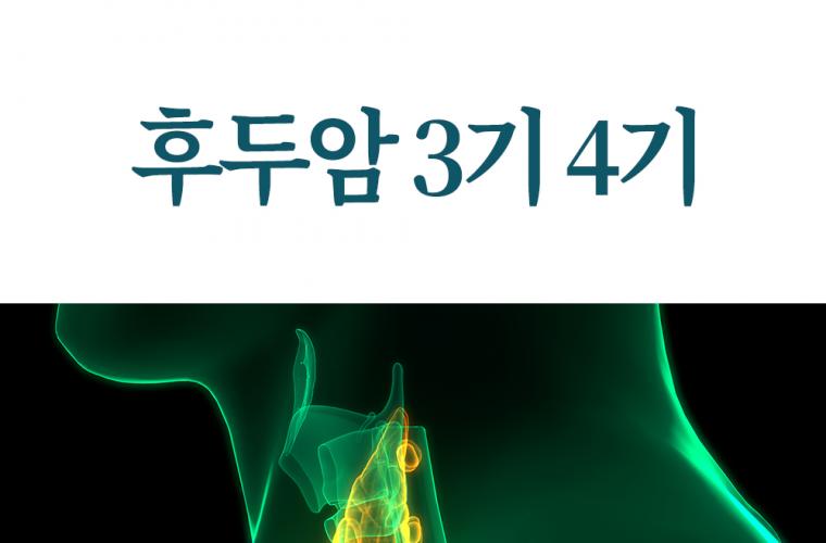 후두암 3기 4기 생존율 기수별 치료 관리 방법은? 썸네일 이미지