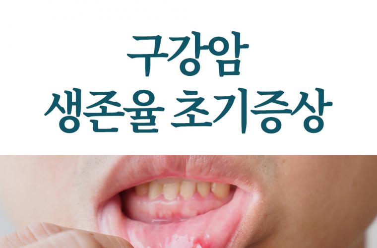 구강암 생존율 초기증상 완치율 높이기 위해서는 썸네일 이미지