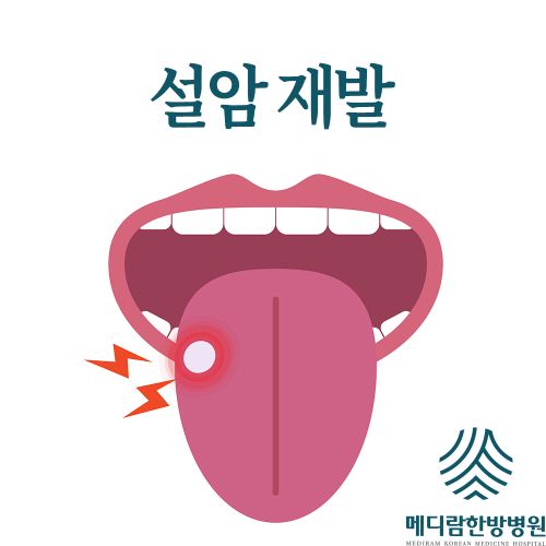 설암 재발 확률 초기증상 생존율 높이는 방법은? 썸네일 이미지